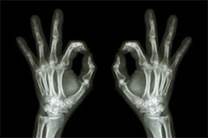 zdjęcie rentgenowskie