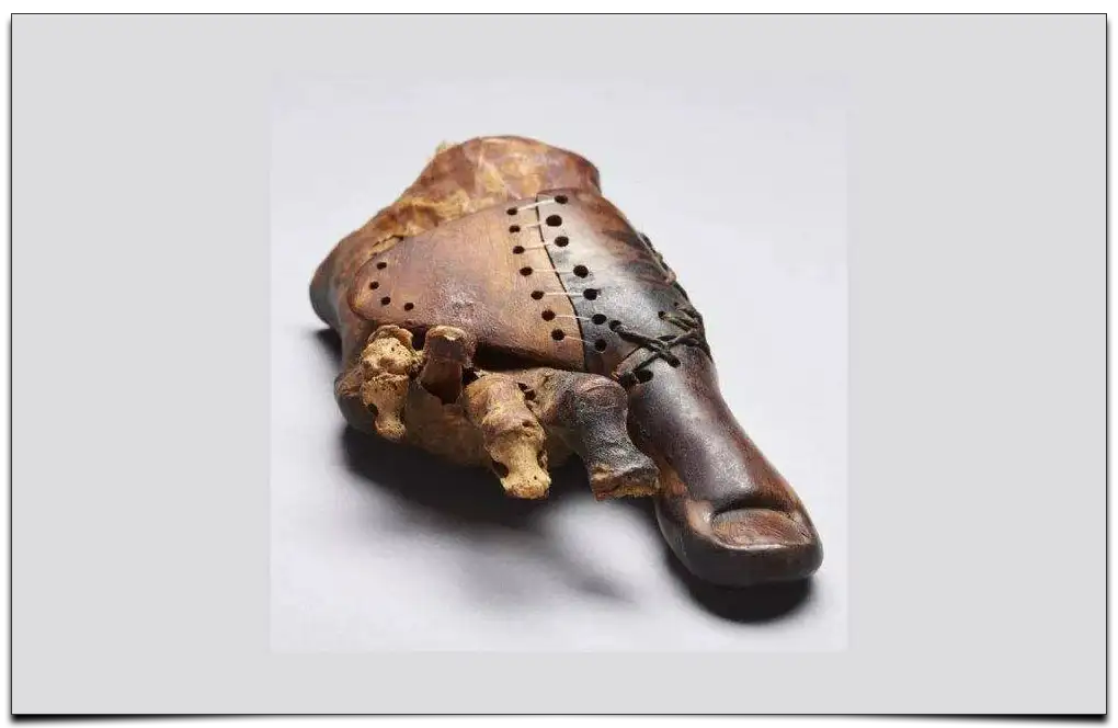 proteza